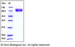 Sino Biological Influenza A H5N1 (A/Indonesia/5/2005) Hemagglutinin / HA