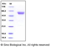 Sino Biological Recombinant Human Podoplanin Protein (ECD, His & hFc Tag),