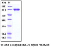 Sino Biological Influenza A H1N1 (A/Brevig Mission/1/1918) Hemagglutinin