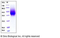 Sino Biological Human respiratory syncytial virus (RSV) (A, rsb1734) glycoprotein