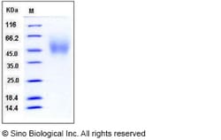 Sino Biological Recombinant Human TrkA Protein (aa 194-413, His Tag), HPLC-verified,