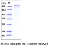 Sino Biological Recombinant Human VLDL Receptor/VLDLR Protein (His Tag),
