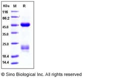 Sino Biological Recombinant Human Factor X Protein (His Tag), HPLC-verified,