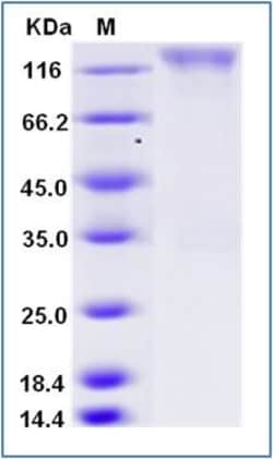 Sino Biological Recombinant Human CEACAM-5/CD66e Protein (hFc Tag), HPLC-verified,