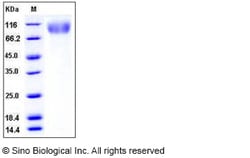 Sino Biological Recombinant Human CEACAM-5/CD66e Protein (His Tag), HPLC-verified,