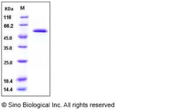 Sino Biological Human Glucokinase / GCK Protein 50ug, Quantity: Each of
