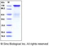 Sino Biological Human Insulin Receptor / INSR / CD220 Protein (long isoform,