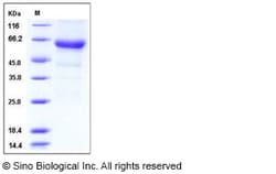 Sino Biological Influenza A H7N7 (A/Netherlands/219/2003) Hemagglutinin