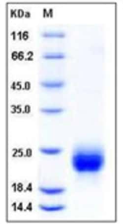 Sino Biological Human RSPO1 Protein 100ug (Sino Biological), Quantity: