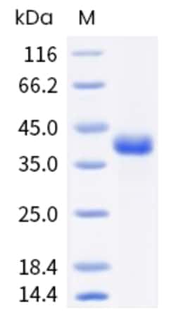 Sino Biological Human R-Spondin 1 / RSPO1 Protein 1mg, Quantity: Each of