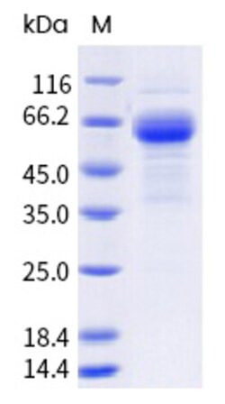 Sino Biological Recombinant Human TREM-2 Protein (ECD, hFc Tag), HPLC-verified,
