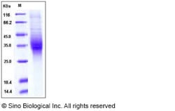 Sino Biological Human TREM2 Protein (ECD,His Tag) 1mg, Quantity: Each of