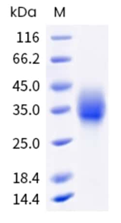 Sino Biological Human TREM-2 Protein (ECD, His & AVI Tag), Biotinylated