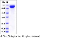 Sino Biological Influenza A H1N1 (A/California/07/2009) Hemagglutinin /