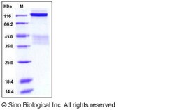 Sino Biological Recombinant Human Insulin Receptor Protein (ECD, short