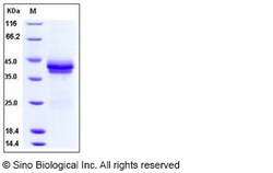 Sino Biological Recombinant Rhesus DKK-1 Protein (256 Asn/Gln, His Tag),