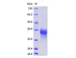 Sino Biological Human CD74 Protein (ECD, His Tag) 1mg, Quantity: Each of