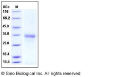 Sino Biological Human CD74 Protein (ECD, His Tag) 100ug, Quantity: Each