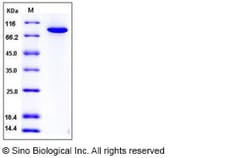 Sino Biological Human TGM2 / Transglutaminase 2 Protein (His Tag) 100ug,