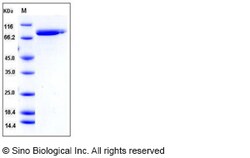 Sino Biological Recombinant Human Lactoferrin/LTF Protein (His Tag), HPLC-verified,