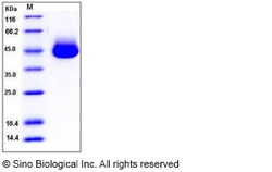 Sino Biological Recombinant Human PEDF/Serpin F1 Protein (His Tag), HPLC-verified,