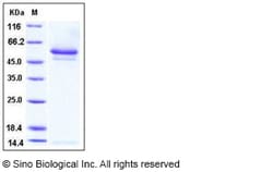 Sino Biological Recombinant Human Neuroserpin Protein (His Tag), Quantity: