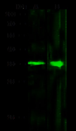 Sino Biological ACBD6 Antibody, Mouse MAb 100µL, Quantity: Each of 1