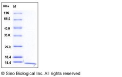 Sino Biological Recombinant Human S100A16 Protein, Quantity: Each of 1
