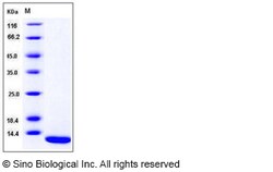 Sino Biological Human S100A7 / PSOR1 Protein 50ug, Quantity: Each of 1