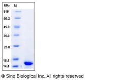Sino Biological Recombinant Human S100A9 Protein (His Tag) 1, Quantity: