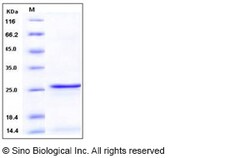 Sino Biological Human S100A9 / CAGB / P14 Protein 100ug, Quantity: Each