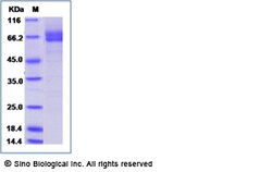 Sino Biological Recombinant Human Galectin-9/LGALS9 Protein (hFc Tag),