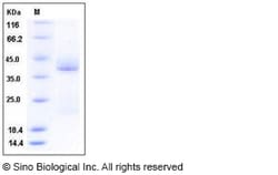 Sino Biological Recombinant Human CD69 Protein (His Tag), Quantity: Each