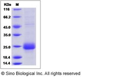 Sino Biological Human CTLA4 / CD152 Protein (His Tag), Biotinylated 20ug,