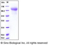 Sino Biological Recombinant Human CADM1 Protein (His Tag), HPLC-verified,