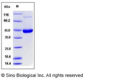 Sino Biological Recombinant Human ENTPD5 Protein (His Tag), Quantity: Each