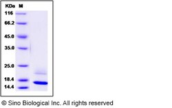 Sino Biological Recombinant Human REG4 Protein (His Tag), HPLC-verified,