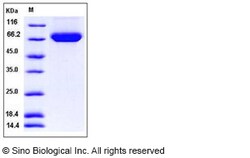 Sino Biological Recombinant Human B7-H3 Protein (His Tag), Amine-Labeled