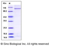 Sino Biological Recombinant Human PARP3 Protein (His & GST Tag), Quantity: