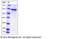 Sino Biological Recombinant Human CDKL2 Protein (His Tag), Quantity: Each