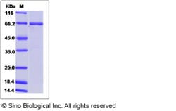 Sino Biological Recombinant Human c-Abl/ABL1 Protein (GST Tag), HPLC-verified