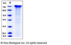 Sino Biological Recombinant Human CD96 Protein (His Tag), HPLC-verified,