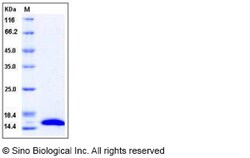 Sino Biological Human CRABP2 Protein (His Tag) 100ug, Quantity: Each of