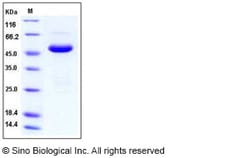 Sino Biological Human SETD7 / SET7/9 Protein (His Tag) 100ug, Quantity: