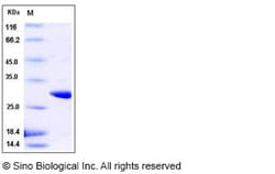 Sino Biological Recombinant Schistosoma japonicum GST Protein 1, Quantity: