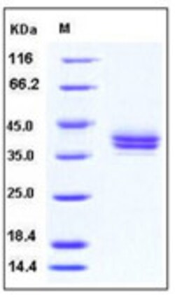 Sino Biological Human CADM3 / NECL1 / IGSF4B Protein (His Tag) 100ug, Quantity: