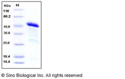Sino Biological Recombinant Human RIZ1 Protein (GST Tag), Quantity: Each