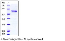 Sino Biological Recombinant Human SMYD3 Protein (GST Tag), Quantity: Each