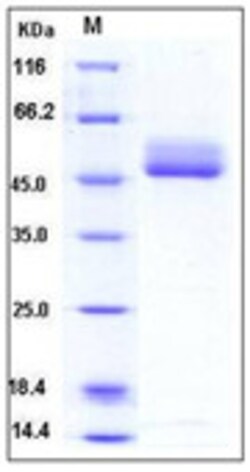 Sino Biological Human B4GALT1 / GGTB2 Protein (His Tag) 20ug, Quantity: