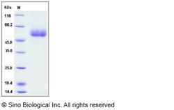 Sino Biological Recombinant Human Apolipoprotein H Protein (His Tag), HPLC-verified,